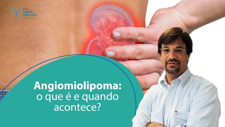 Sintomas de Angiomiolipoma: Guia Completo