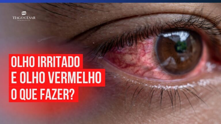 Causas comuns de irritação nos olhos