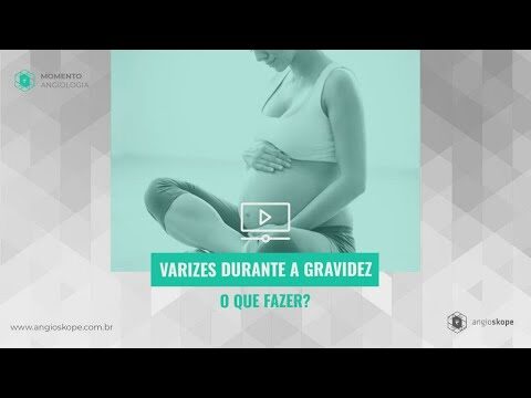 Varizes na gravidez: como fazer elas desaparecerem