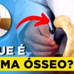 Marcapasso Provisorio: Indicações e Cuidados Essenciais