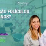 5 Maneiras de Melhorar as Varizes de Forma Eficiente