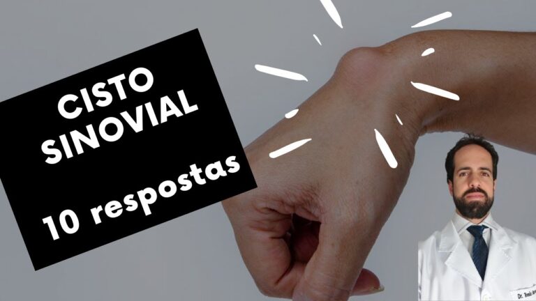 Como tratar um cisto em cima da mão