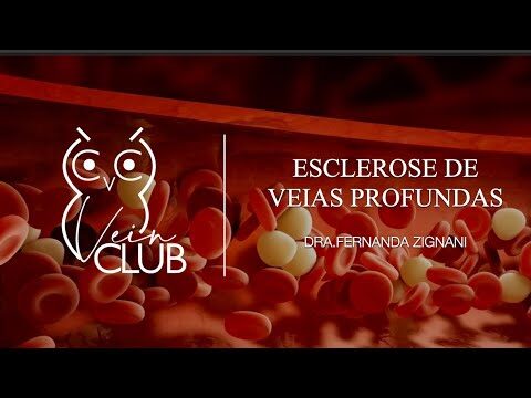 Veia Esclerosada: Causas, Sintomas e Tratamentos