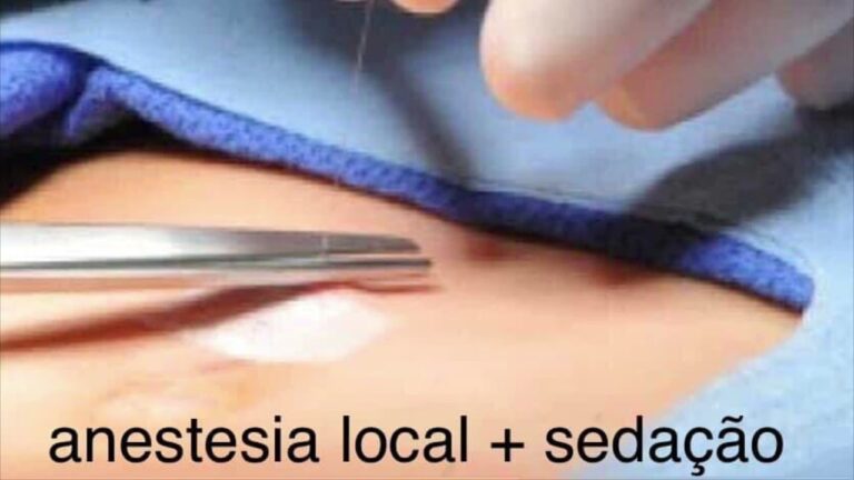Duração da cirurgia de hérnia inguinal: o que esperar
