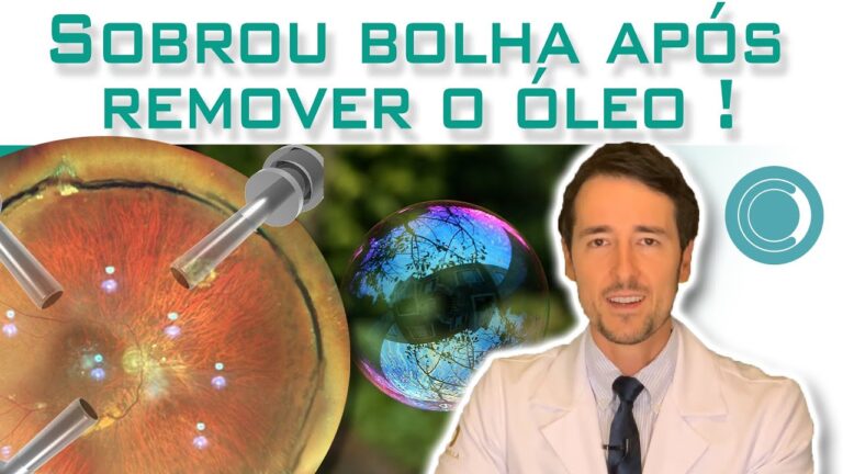 Como tratar eficazmente uma bolha de ar no olho