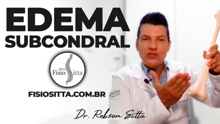 Tratamento de Edema Ósseo: Eficácia da Fisioterapia