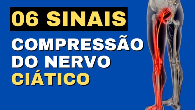 Sintomas da compressão do nervo: o que observar