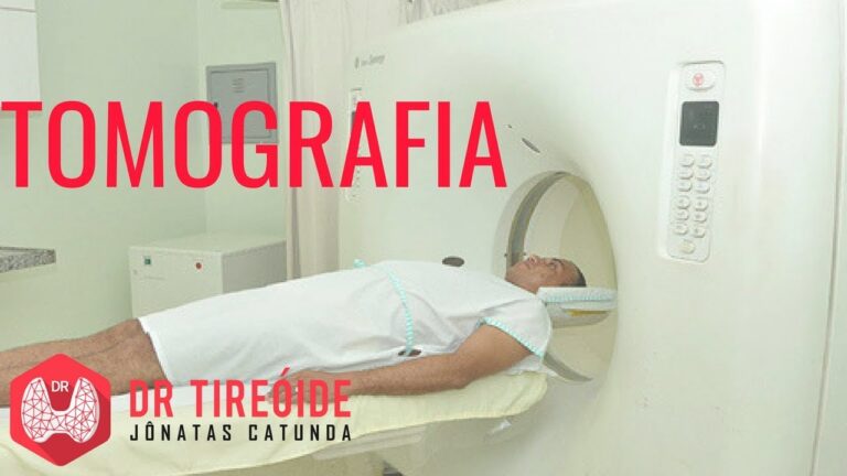 Tomografia da Tireoide: Diagnóstico Preciso e Rápido