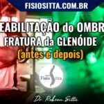 Síndrome de Colisão do Ombro: Causas e Tratamentos