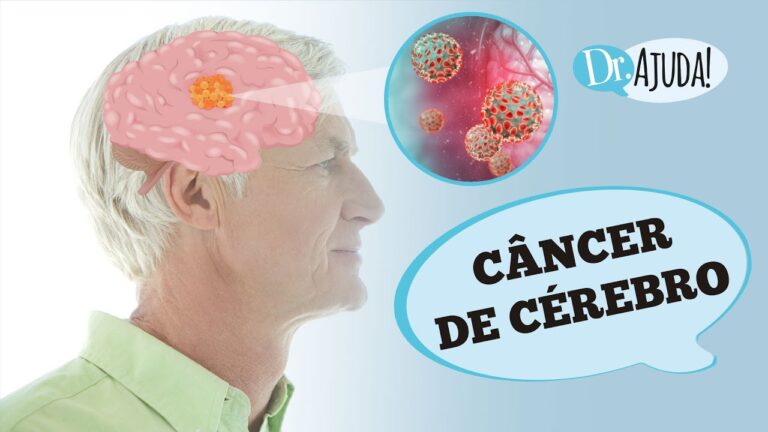 Câncer Cerebral em Estágio Terminal: O Que Esperar