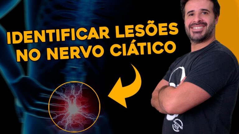 Lesão do Nervo Ciático: Causas, Sintomas e Tratamentos