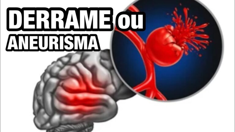 Entenda a Diferença entre AVC e Aneurisma