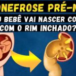 Correção da Cabeça Torta do Bebê: Volta ao Normal