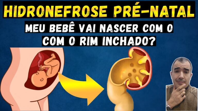 Rim dilatado em beb&ecirc; durante a gravidez: medidas a tomar