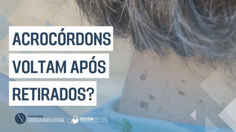 Acrocórdons Inflamados: Causas e Tratamentos