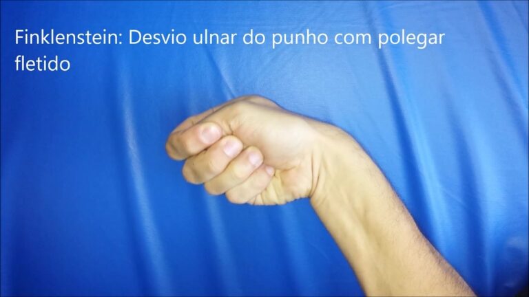 Teste de Quervain: Diagnóstico e Tratamento