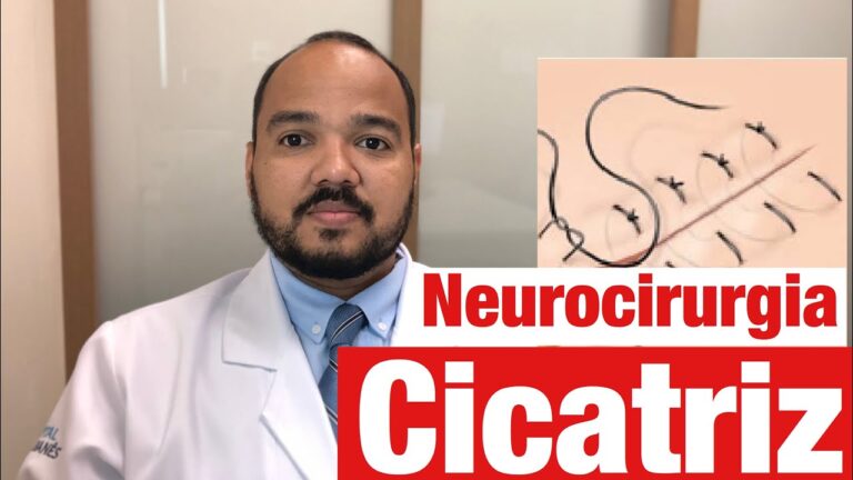 Cicatriz de Meningioma: O Que Você Precisa Saber