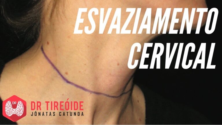 Fotos do Esvaziamento Cervical: Guia Completo e Detalhado