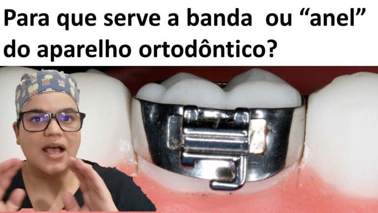 O poder do aparelho anel: vantagens e usos