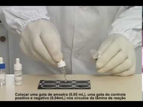 Guia Completo para o Exame de Sangue com Teste de Látex
