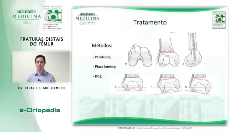 Fratura do Fêmur Distal: Diagnóstico e Tratamento