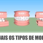 Como Aliviar Cicatriz Co&ccedil;ando: Dicas e Tratamentos