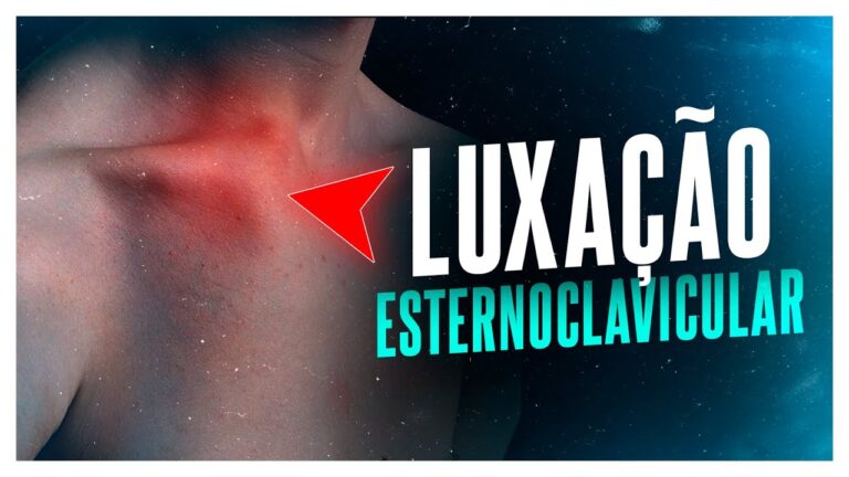 Luxação esternoclavicular: gravidade e tratamento