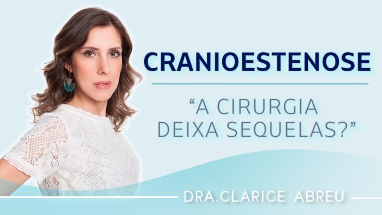 Sequelas da Cranioestenose: Consequências e Tratamentos