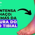 Fratura de nariz: Como identificar e tratar