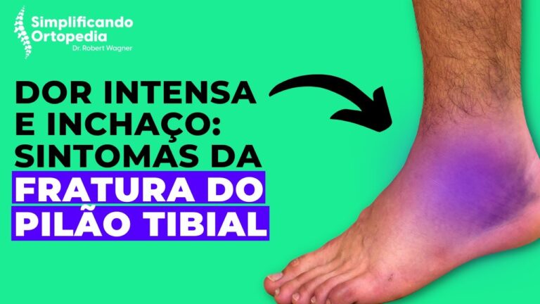 Fratura do Pilão Tibial: Diagnóstico e Tratamento