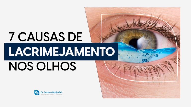 A Ciência por Trás do Olho Lacrimejante