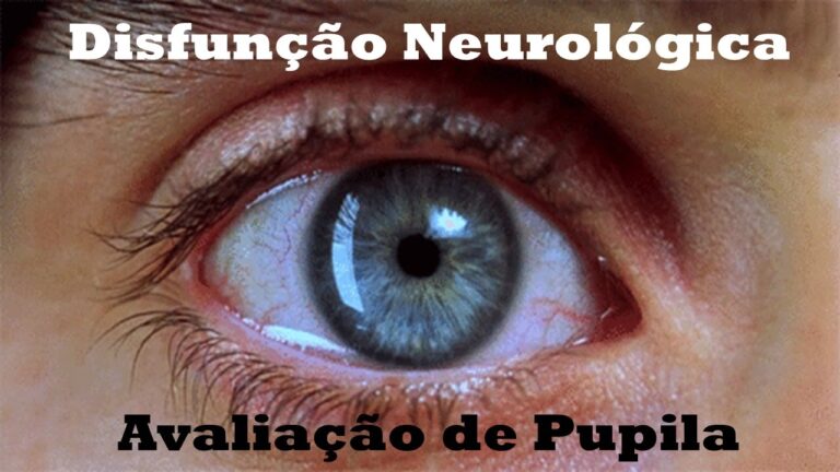 Significado das pupilas não fotorreagentes: explicação concisa