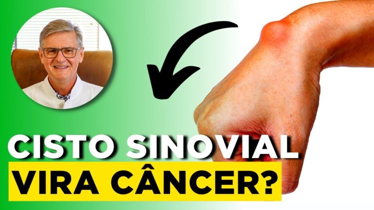 Como tratar eficazmente um caro&ccedil;o em cima da m&atilde;o