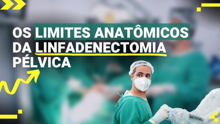 A Importância da Linfadenectomia Pélvica Feminina