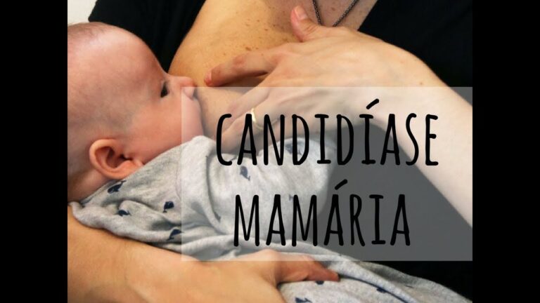 Candidíase no Seio: Causas, Sintomas e Tratamentos Eficazes