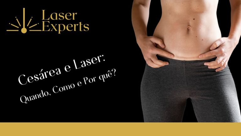 Vantagens da Cesárea a Laser: Uma Opção Segura e Eficiente