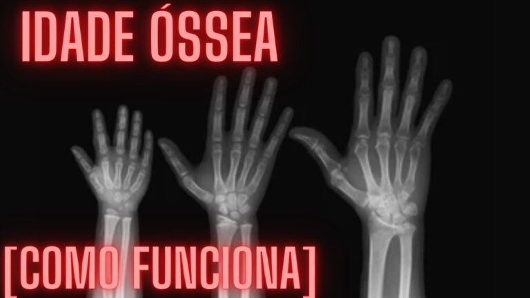 Interpretação da Idade Óssea com RX: Guia Completo