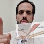 Ginecomastia em Mulheres: Causas, Sintomas e Tratamentos