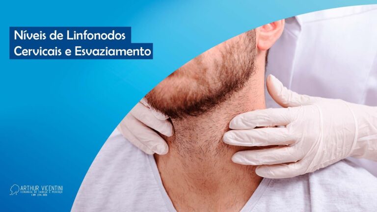 Linfonodos N&iacute;vel 2 e 3: O Que Voc&ecirc; Precisa Saber