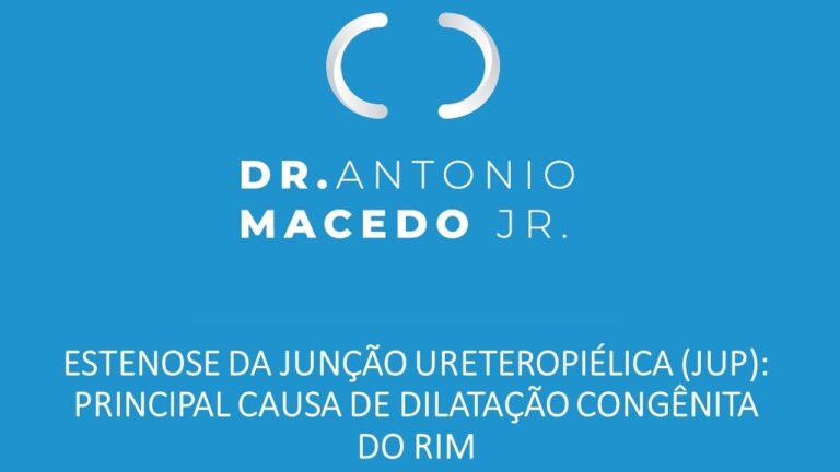 Anomalia da Jun&ccedil;&atilde;o Ureteropi&eacute;lica: Diagn&oacute;stico e Tratamento