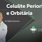 Partes do Bra&ccedil;o e Antebra&ccedil;o: Guia Completo