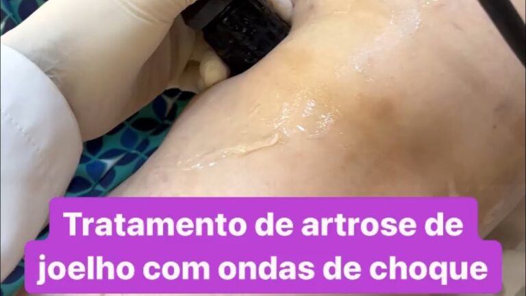 Choque no Joelho: Causas, Sintomas e Tratamentos