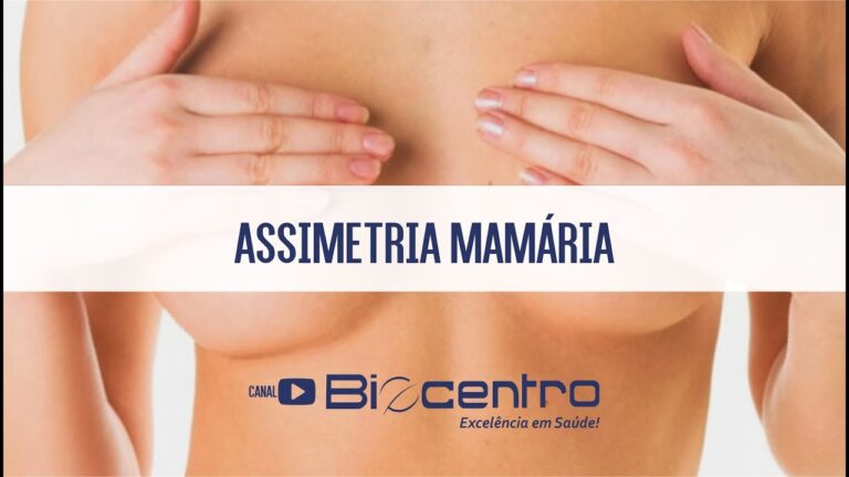 Assimetria dos Seios: Causas e Tratamentos