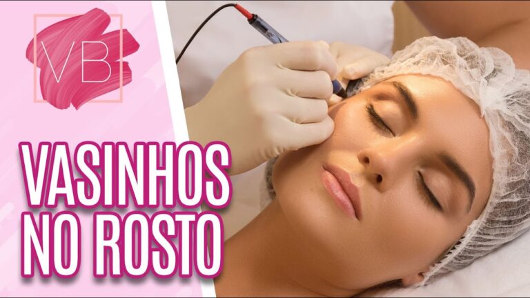 Veias do Rosto: O Que São e Como Tratá-las