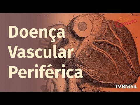 Entendendo a Doença Vascular Periférica