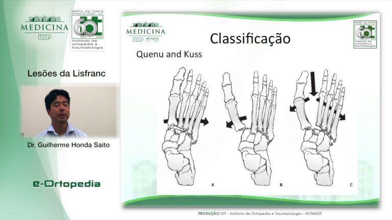 Les&atilde;o de Lisfranc: Diagn&oacute;stico, Tratamento e Reabilita&ccedil;&atilde;o