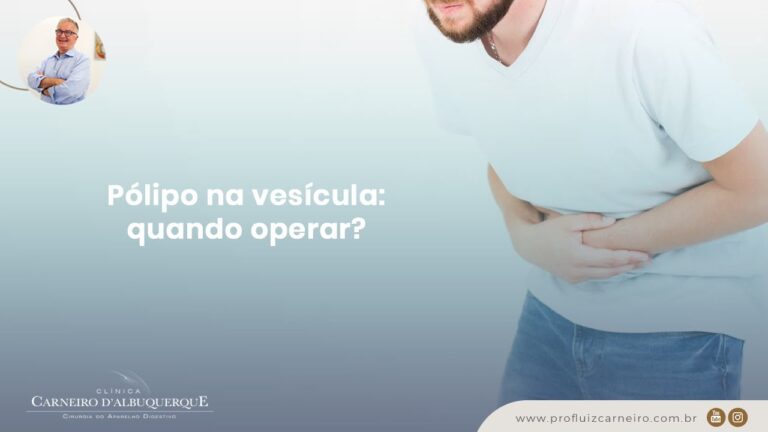 Pólipo Vesicular de 0,3 cm: Tudo o que Você Precisa Saber