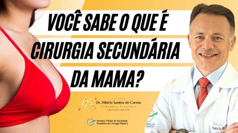 Desafios e Conquistas da Mama Secundária: Um Guia Completo