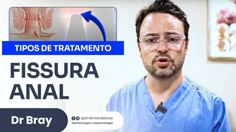 Guia Completo para a Cauterização de Fissuras