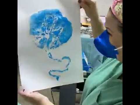 A importância da árvore de placenta na gravidez: tudo o que você precisa saber